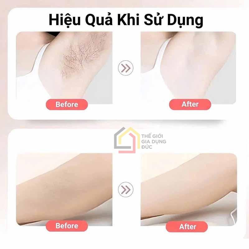 combo-lam-mem-da-balea-tay-long-va-duong-da-sau-tay (6) Kem dưỡng ức chế mọc lông Balea 125ml