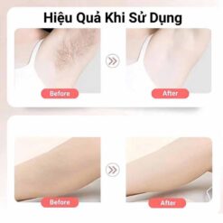 Combo làm mềm da Balea - Tẩy lông và dưỡng da sau tẩy