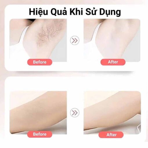 Combo làm mềm da Balea - Tẩy lông và dưỡng da sau tẩy